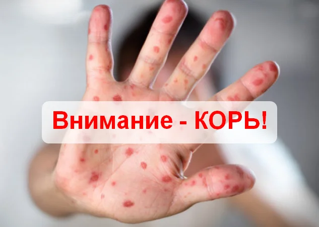 Внимание, КОРЬ!