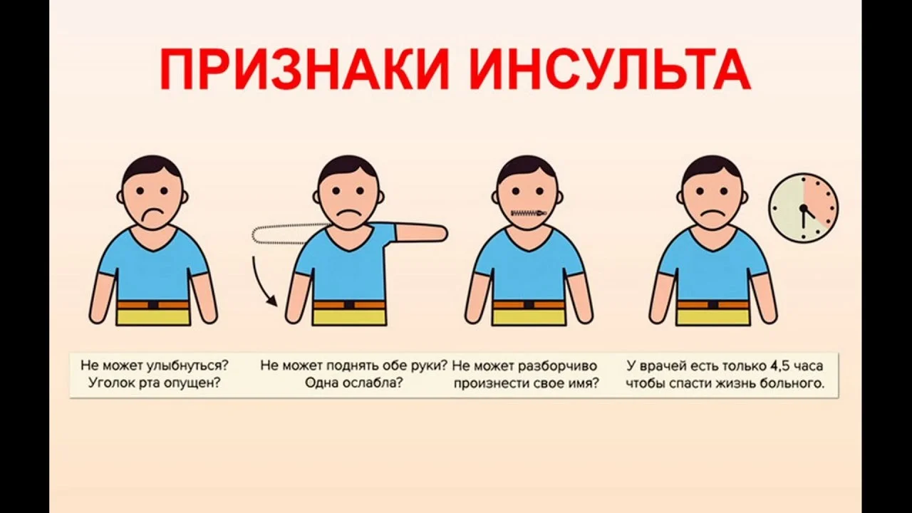 О симптомах инсульта и первой помощи